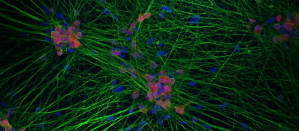 iPSC-derived-neuron