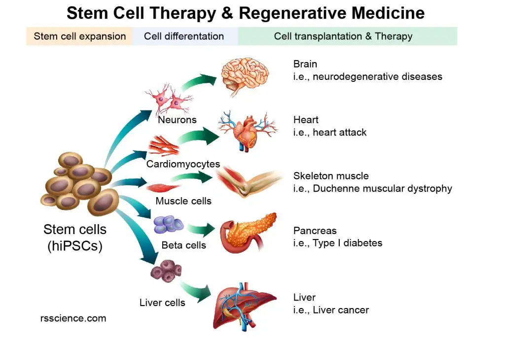 stem-cell-therapy-regenerative-medicine