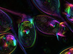 Polarized-Light-Vorticella