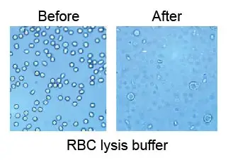 RBC-lysis-buffer