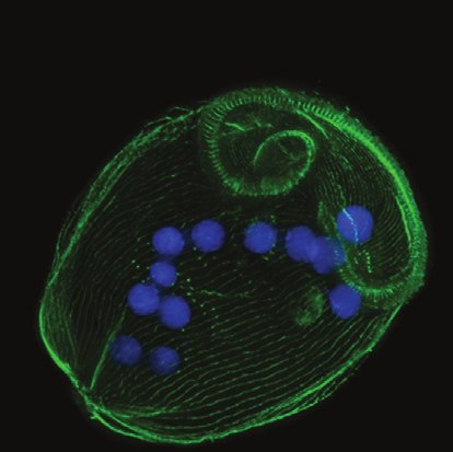 Stentor-coeruleus-Macronuclear-Genome