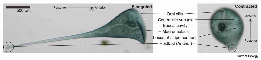 Stentor-coeruleus-anatomy-contracted-and-extended-form