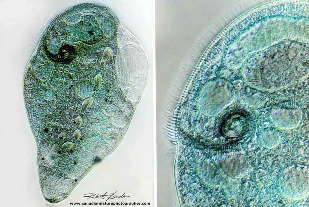 Stentor-coeruleus-stentorin-pigment