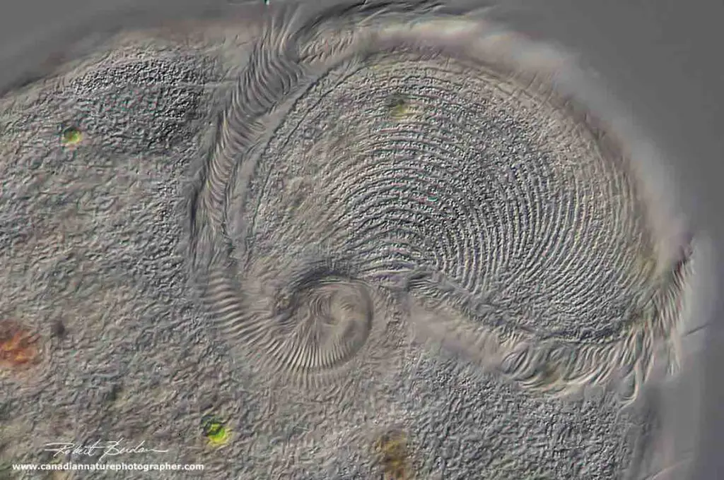 Stentor-cytostome-DIC