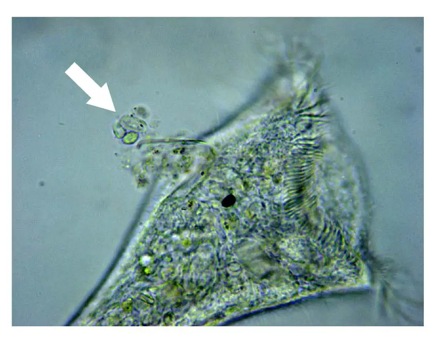 Stentor-food-vacuole