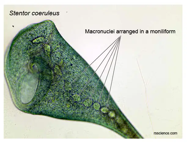 Stentor-moniliform-macronuclei