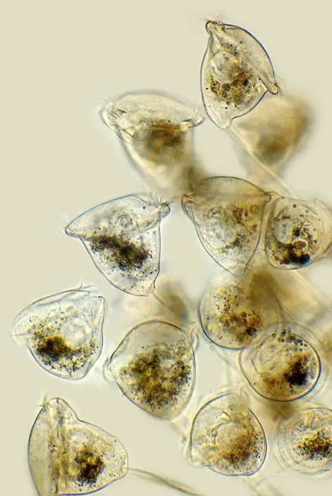 Vorticella-bell-shaped-body