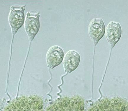 Vorticella-convallaria