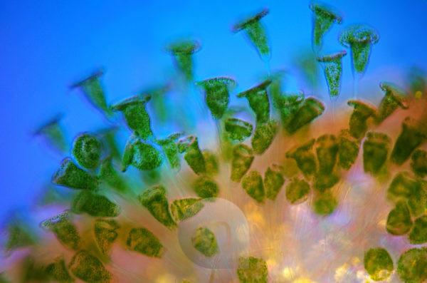 Vorticella-green-algae