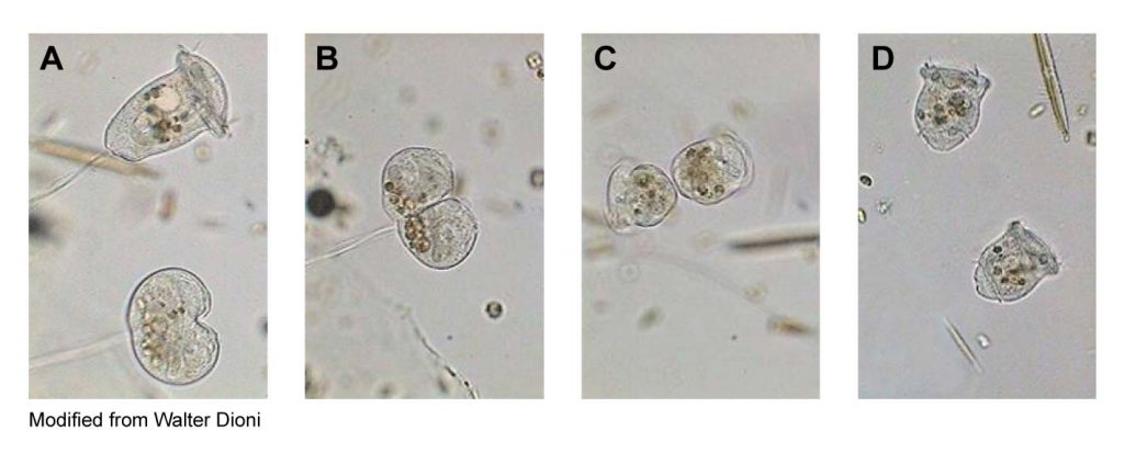 Vorticella-reproduction