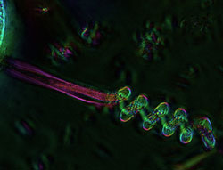 Vorticella-stalk