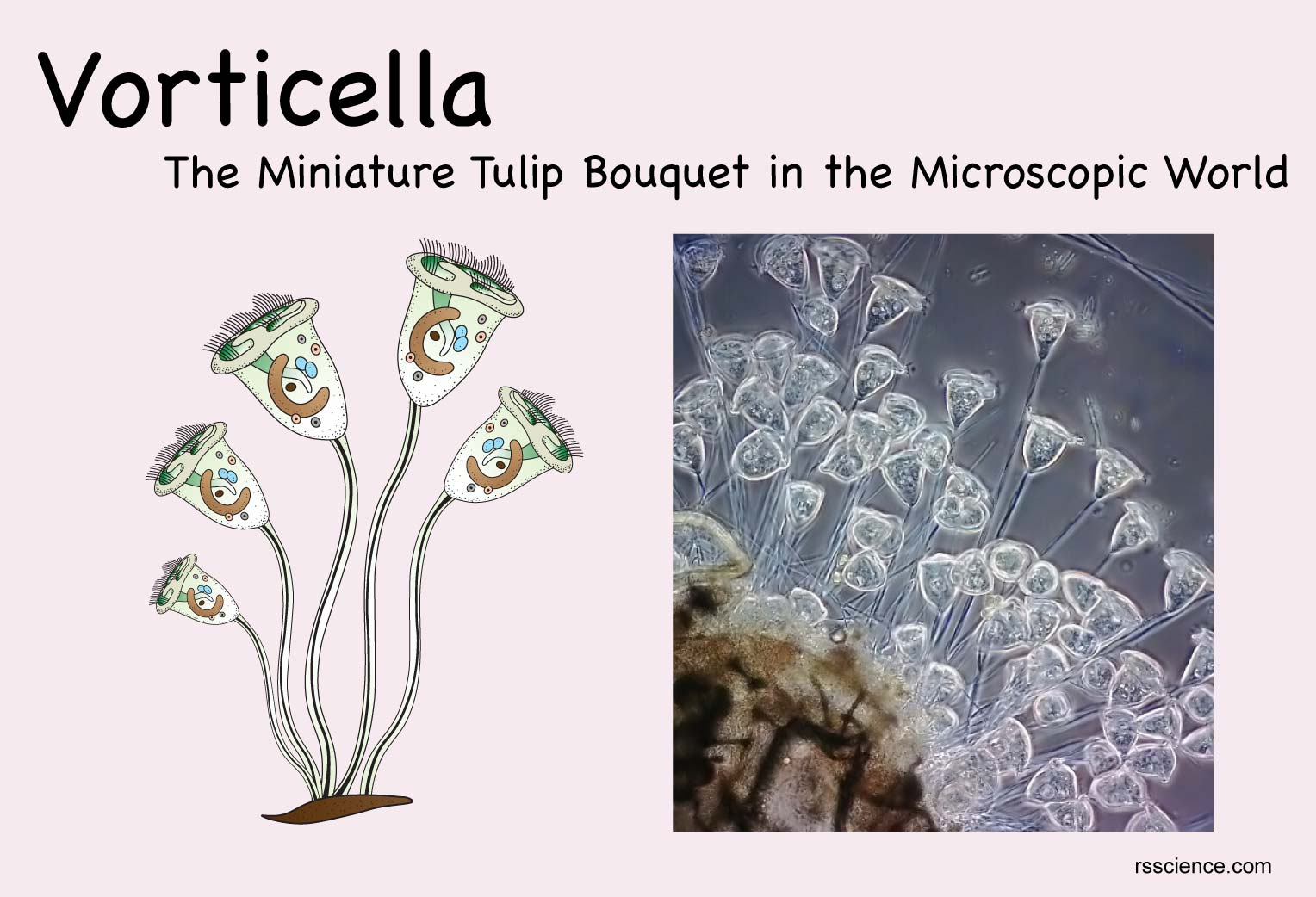 vorticella labeled nucleus