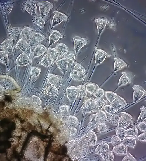 Vorticella