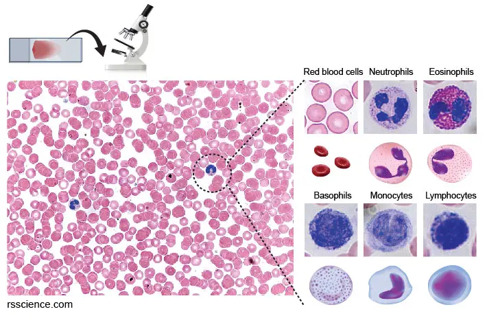 blood-smear-Wright-Giemsa-stains