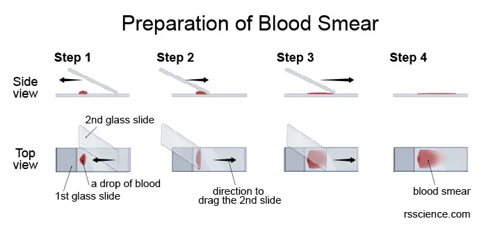 blood-smear-preparation
