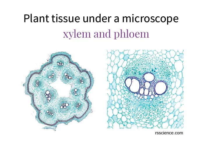 plant tissue under a microscope