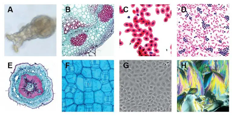 Different types of Microscopes – light microscope, electron microscope ...