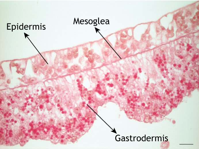 hydra-epidermis-and-gastrodermis