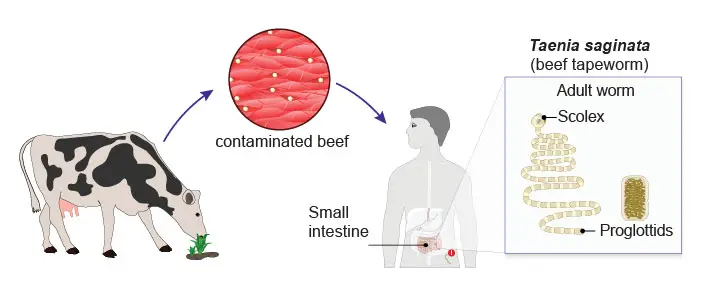 Tapeworm-infections