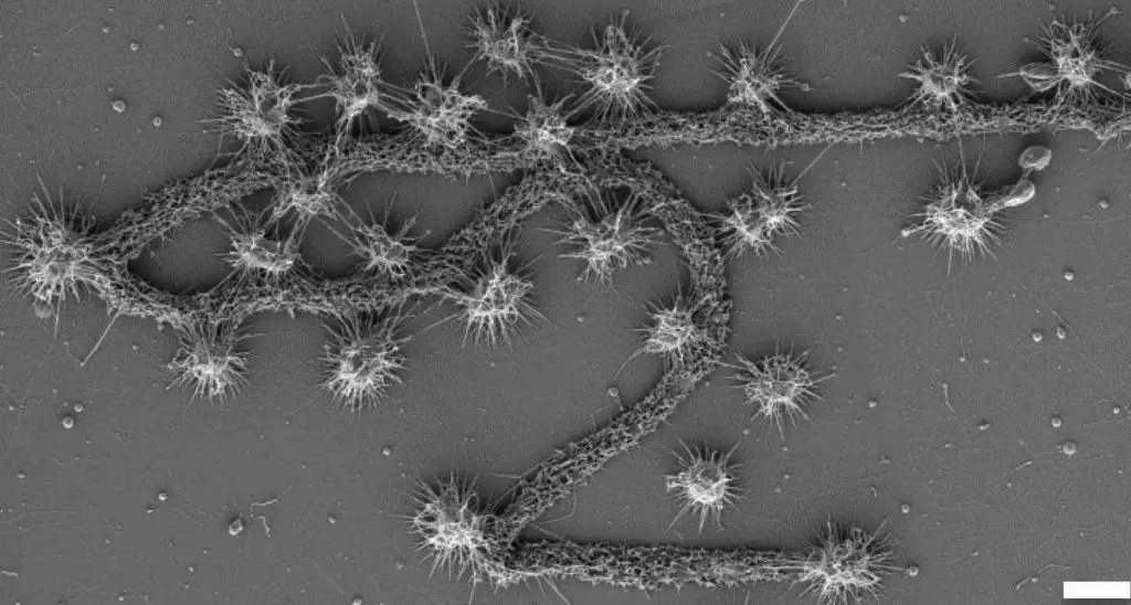 Archaea - Definition, Structure, Types & Extremophile Habitats - Rs ...