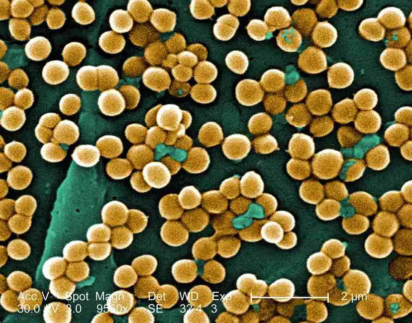 Methicillin-resistant-Staphylococcus-aureus