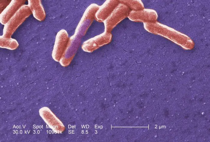 Scanning_electron_micrograph_of_an_E._coli_colony