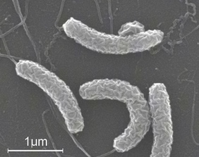 vibrio-cholerae-under-electron-microscope
