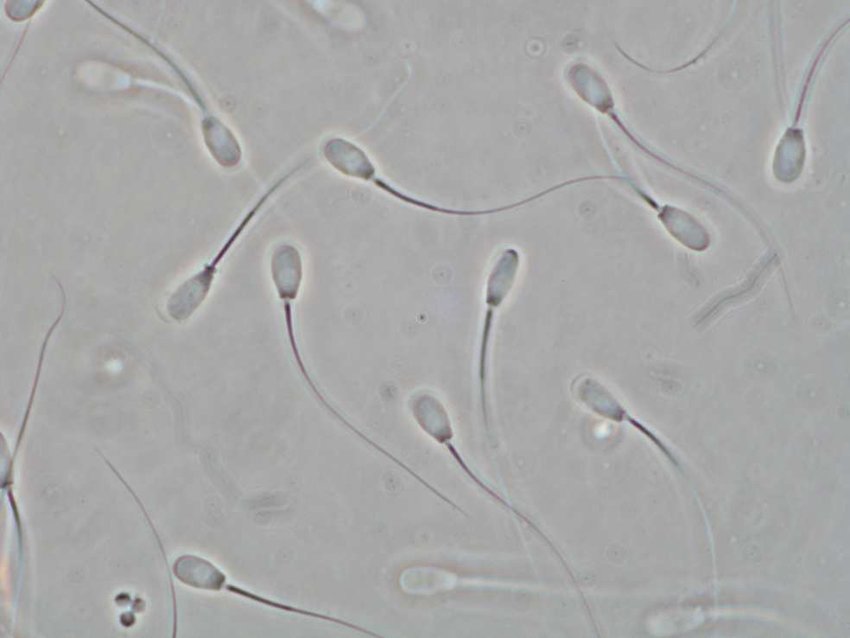 Boar-semen-sample-images-acquired-using-a-phase-contrast-microscope