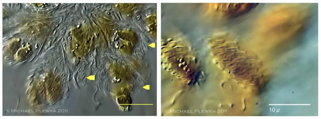 synura-scale-phase-contrast-microscope