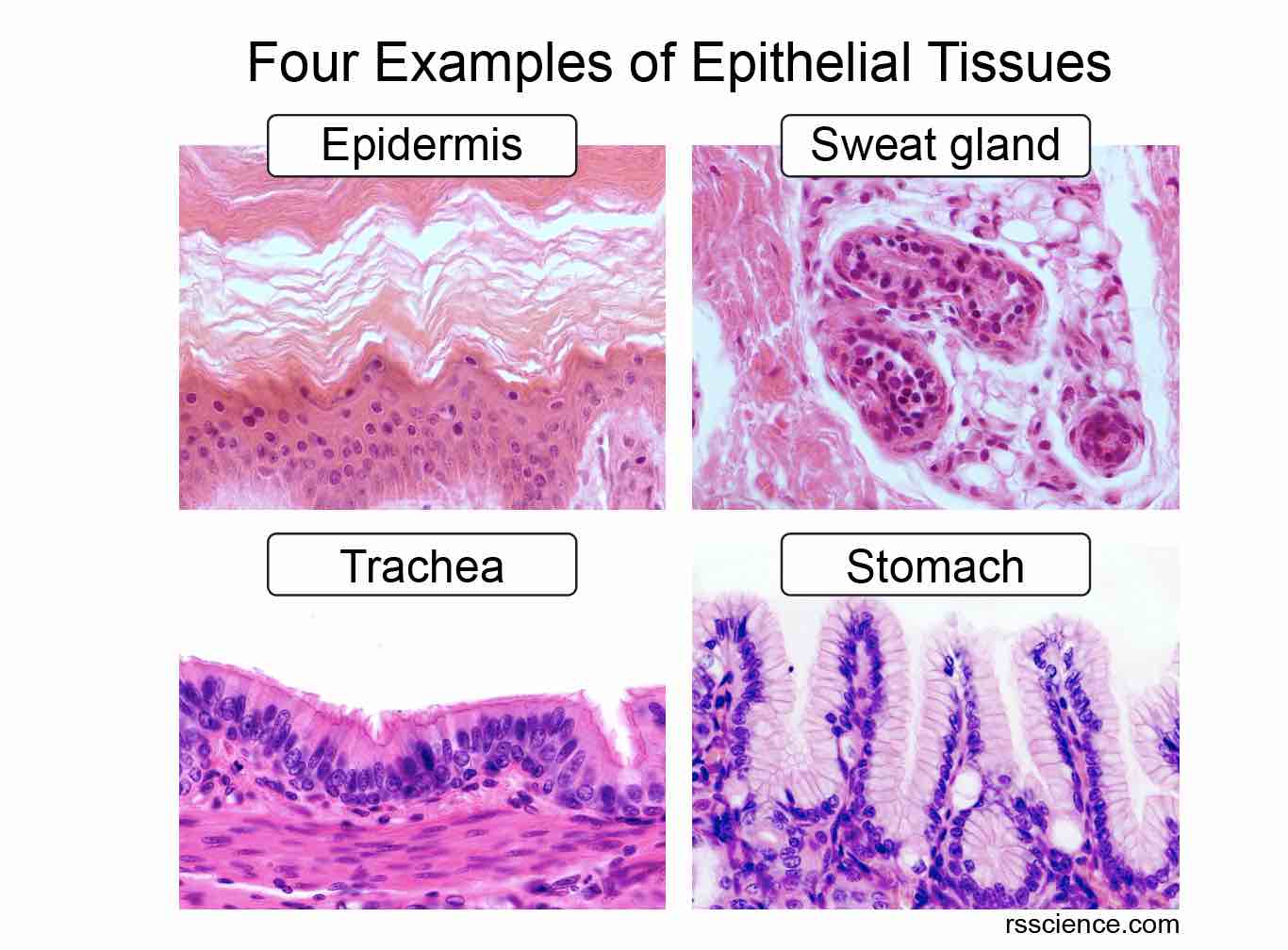 Diagrams Of Epithelial Tissue