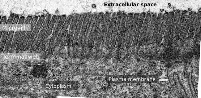 microvilli-intestine-epithelium-TEM