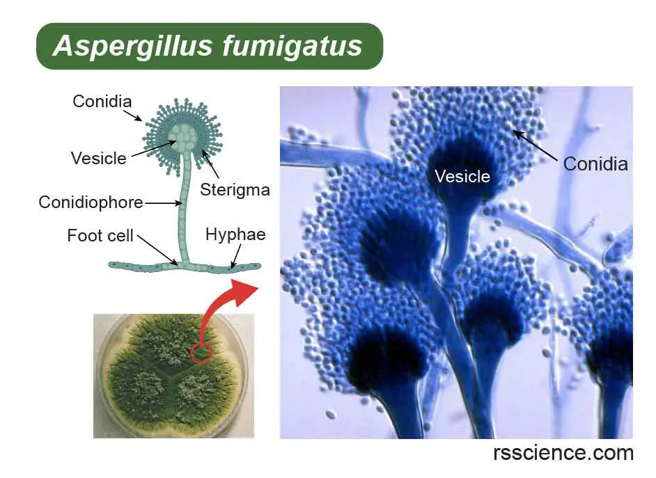Aspergillus-fumigatus