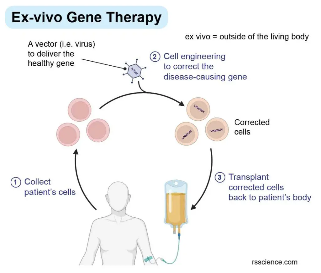 ex-vivo-gene-therapy