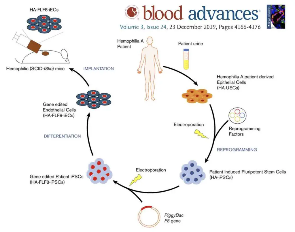 iPSC-ex-vivo-gene-therapy-treat-hemophilia
